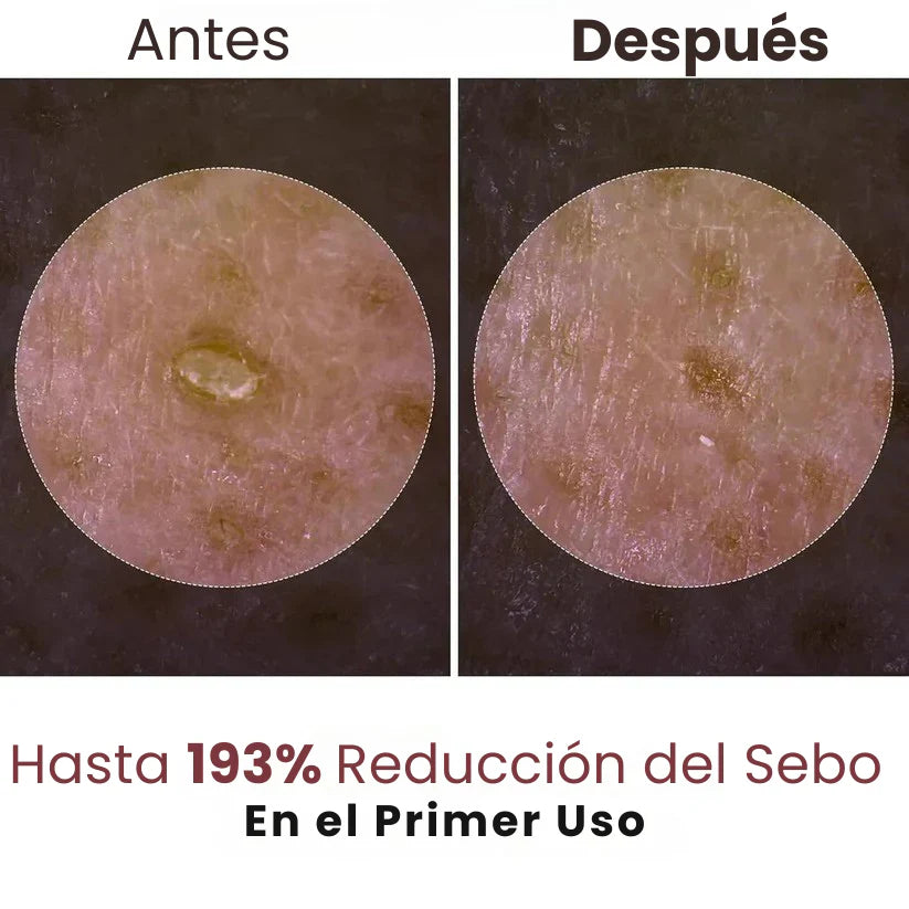 Ampolla Exfoliante de Arroz – Efecto Glow