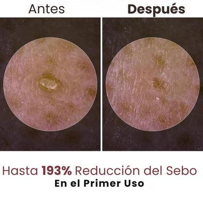 Ampolla Exfoliante de Arroz – Efecto Glow