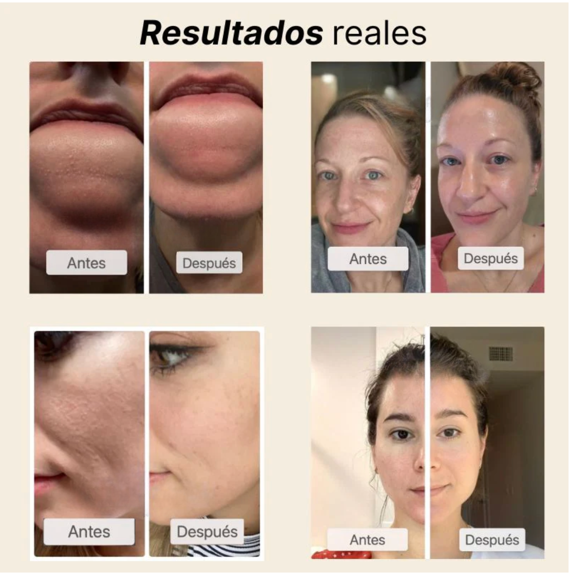 Ampolla Exfoliante de Arroz – Efecto Glow