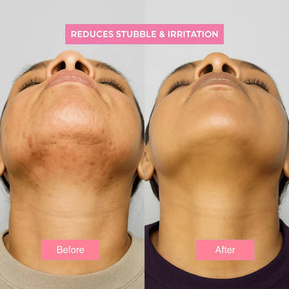 Lunilla Cyperus Rotundus Oil