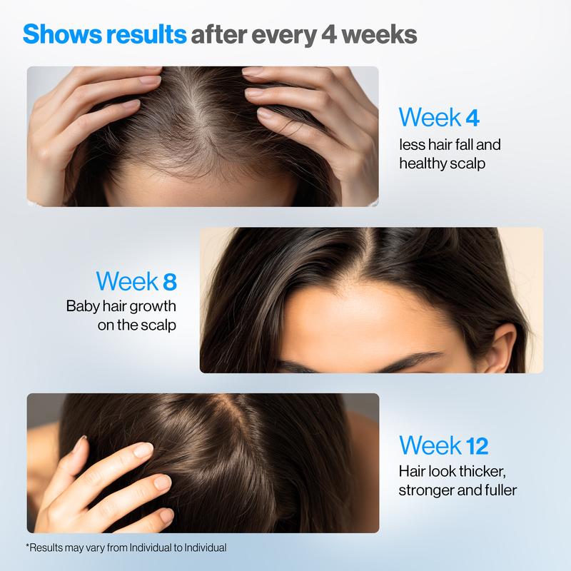 Rosemary Hair Growth Serum